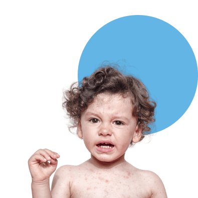 Criança tomando vacina da tríplice viral